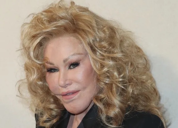 Jocelyn Wildenstein Net Worth